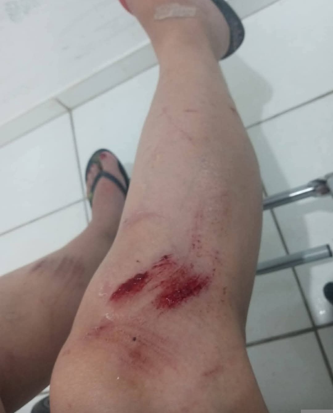 MULHER É AGREDIDA E AMEAÇADA DE MORTE PELO SOBRINHO EM ALMIRANTE TAMANDARÉ.