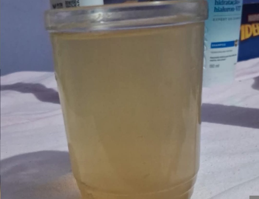 FALTA DE ÁGUA E ÁGUA SUJA: