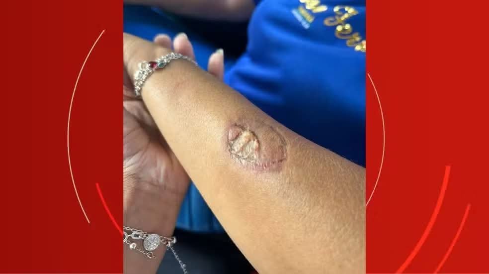 MÃE DE ALUNO MORDE DIRETORA DENTRO DE ESCOLA NO PARANÁ.