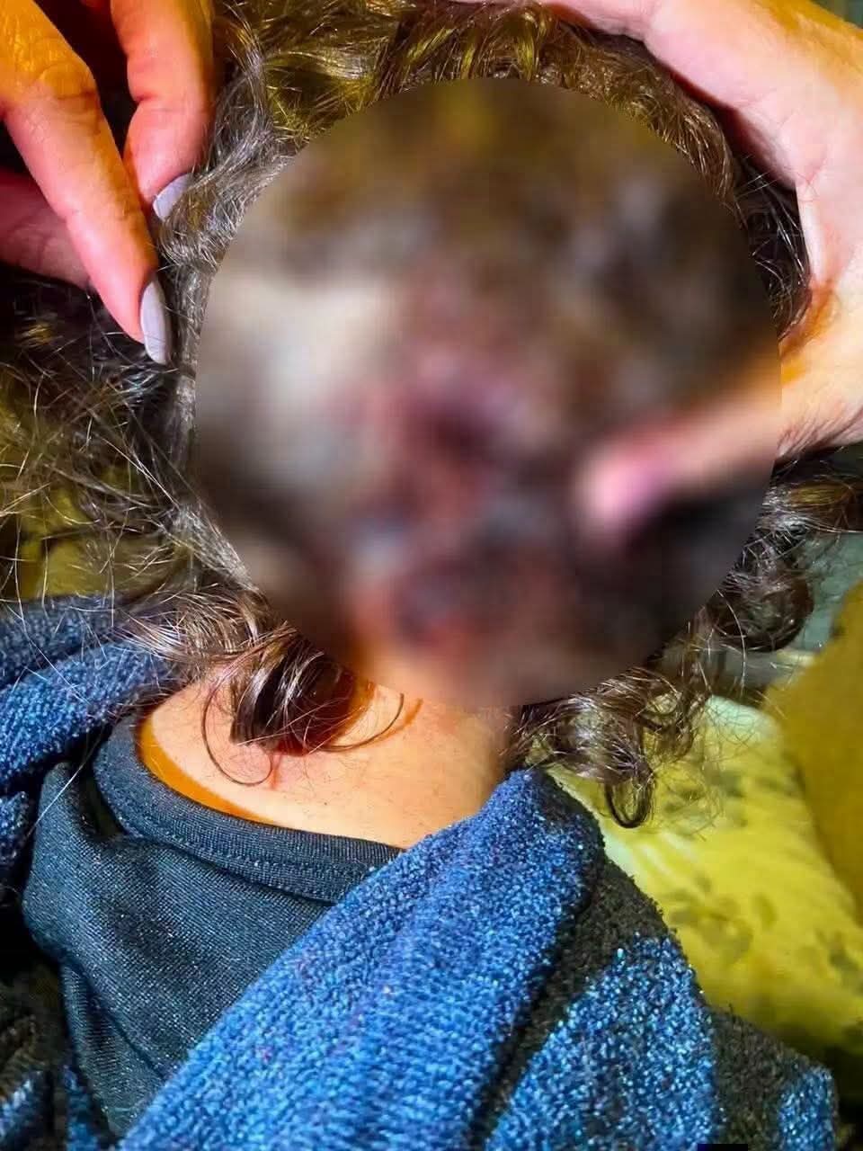 FAMÍLIA COBRA EXPLICAÇÕES APÓS CRIANÇA DE 4 ANOS SOFRER TRAUMATISMO CRANIANO EM CMEI DE CURITIBA.